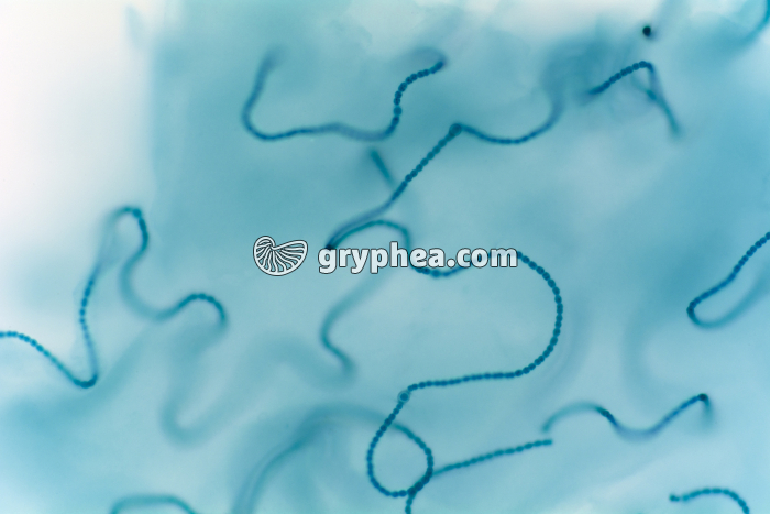 Cyanobactéries - Nostocs - écrasement x100 - gryphea.org